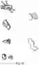 Fig. 47 - ENDOSCOPIC DEVICE WITH ADDITIONAL CHANNEL