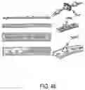 Fig. 48 - ENDOSCOPIC DEVICE WITH ADDITIONAL CHANNEL