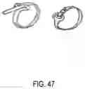 Fig. 49 - ENDOSCOPIC DEVICE WITH ADDITIONAL CHANNEL