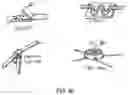 Fig. 50 - ENDOSCOPIC DEVICE WITH ADDITIONAL CHANNEL