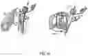 Fig. 51 - ENDOSCOPIC DEVICE WITH ADDITIONAL CHANNEL