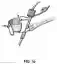 Fig. 54 - ENDOSCOPIC DEVICE WITH ADDITIONAL CHANNEL