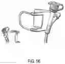 Fig. 58 - ENDOSCOPIC DEVICE WITH ADDITIONAL CHANNEL