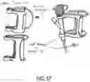 Fig. 59 - ENDOSCOPIC DEVICE WITH ADDITIONAL CHANNEL
