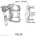 Fig. 61 - ENDOSCOPIC DEVICE WITH ADDITIONAL CHANNEL