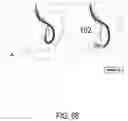 Fig. 70 - ENDOSCOPIC DEVICE WITH ADDITIONAL CHANNEL