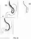 Fig. 71 - ENDOSCOPIC DEVICE WITH ADDITIONAL CHANNEL