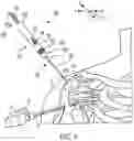 Fig. 13 - Arthroscopic medical implements and assemblies