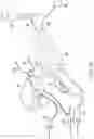 Fig. 21 - Arthroscopic medical implements and assemblies