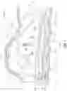Fig. 02 - Endoluminal device with retractor system
