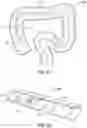 Fig. 03 - Endoluminal device with retractor system