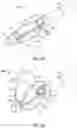 Fig. 11 - Endoluminal device with retractor system