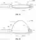 Fig. 12 - Endoluminal device with retractor system