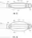 Fig. 13 - Endoluminal device with retractor system