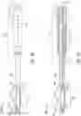 Fig. 14 - Endoluminal device with retractor system