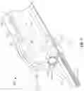 Fig. 16 - Endoluminal device with retractor system