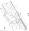 Fig. 17 - Endoluminal device with retractor system