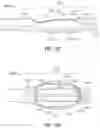 Fig. 20 - Endoluminal device with retractor system