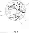 Fig. 04 - Device and method for examining the retinal vascular endothelial function