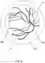 Fig. 07 - Device and method for examining the retinal vascular endothelial function