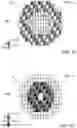 Fig. 09 - Device and method for examining the retinal vascular endothelial function