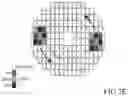 Fig. 10 - Device and method for examining the retinal vascular endothelial function
