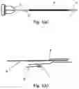 Fig. 02 - MLA-OCT imaging catheter, MLA-OCT imaging system and MLA-OCT imaging method