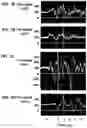 Fig. 04 - Device and method for in vivo flow cytometry using the detection of photoacoustic waves