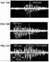 Fig. 14 - Device and method for in vivo flow cytometry using the detection of photoacoustic waves