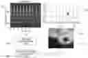 Fig. 01 - SYSTEM AND METHOD OF DETERMINING DISEASE BASED ON HEAT MAP IMAGE EXPLAINABLE FROM ELECTROCARDIOGRAM SIGNAL