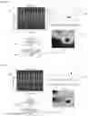 Fig. 05 - SYSTEM AND METHOD OF DETERMINING DISEASE BASED ON HEAT MAP IMAGE EXPLAINABLE FROM ELECTROCARDIOGRAM SIGNAL