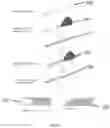Fig. 13 - DEVICES, SYSTEMS AND METHODS FOR TISSUE ANALYSIS, LOCATON DETERMINATION AND TISSUE ABLATION