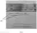 Fig. 16 - DEVICES, SYSTEMS AND METHODS FOR TISSUE ANALYSIS, LOCATON DETERMINATION AND TISSUE ABLATION