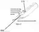 Fig. 19 - DEVICES, SYSTEMS AND METHODS FOR TISSUE ANALYSIS, LOCATON DETERMINATION AND TISSUE ABLATION