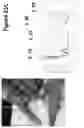 Fig. 45 - DEVICES, SYSTEMS AND METHODS FOR TISSUE ANALYSIS, LOCATON DETERMINATION AND TISSUE ABLATION