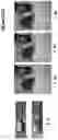 Fig. 46 - DEVICES, SYSTEMS AND METHODS FOR TISSUE ANALYSIS, LOCATON DETERMINATION AND TISSUE ABLATION