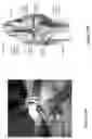 Fig. 51 - DEVICES, SYSTEMS AND METHODS FOR TISSUE ANALYSIS, LOCATON DETERMINATION AND TISSUE ABLATION