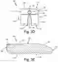 Fig. 04 - ANTENNAS FOR A SUBCUTANEOUS DEVICE