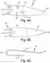 Fig. 05 - ANTENNAS FOR A SUBCUTANEOUS DEVICE