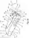 Fig. 28 - ANTENNAS FOR A SUBCUTANEOUS DEVICE