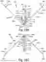 Fig. 32 - ANTENNAS FOR A SUBCUTANEOUS DEVICE