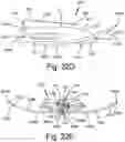 Fig. 33 - ANTENNAS FOR A SUBCUTANEOUS DEVICE