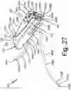 Fig. 43 - ANTENNAS FOR A SUBCUTANEOUS DEVICE