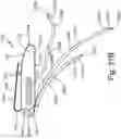 Fig. 48 - ANTENNAS FOR A SUBCUTANEOUS DEVICE