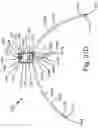 Fig. 50 - ANTENNAS FOR A SUBCUTANEOUS DEVICE