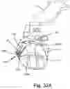 Fig. 52 - ANTENNAS FOR A SUBCUTANEOUS DEVICE