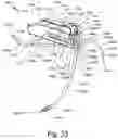 Fig. 55 - ANTENNAS FOR A SUBCUTANEOUS DEVICE
