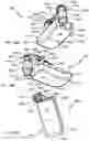 Fig. 69 - ANTENNAS FOR A SUBCUTANEOUS DEVICE