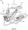Fig. 88 - ANTENNAS FOR A SUBCUTANEOUS DEVICE