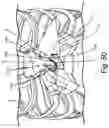Fig. 92 - ANTENNAS FOR A SUBCUTANEOUS DEVICE